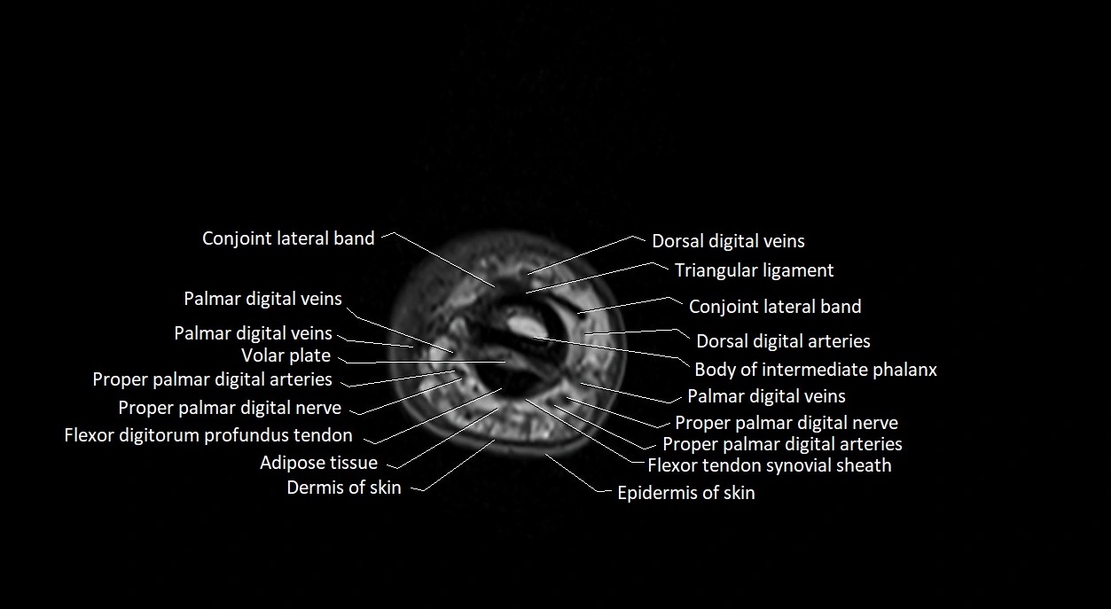 Finger anatomy axial cross sectional 3T image image 9.webp